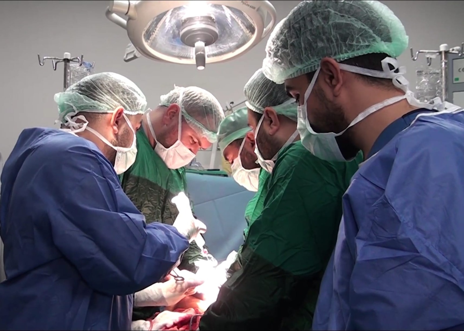BALIKLIGÖL DEVLET HASTANESİ’NDE KARIN BOŞLUĞUNDAN 25 SANTİMETRELİK DEV KİST ÇIKARILDI